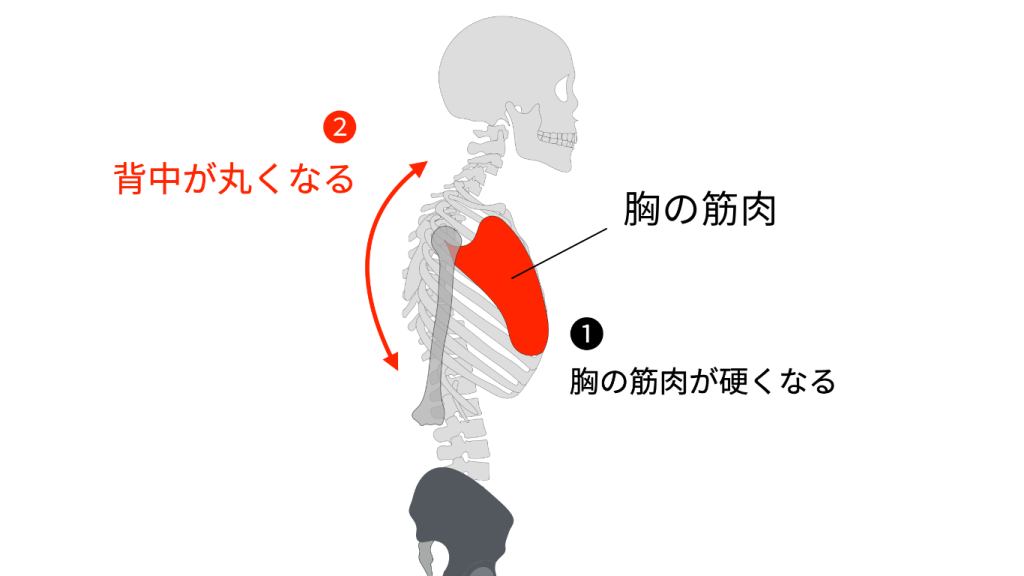 胸が硬くなる　胸椎後弯